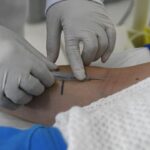 ses-divulga-nota-reforcando-vigilancia-e-ms-segue-sem-casos-confirmados-de-hantavirose-ha-7-anos