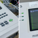 saude:-telemedicina-amplia-acesso-a-eletrocardiogramas-e-fortalece-atendimento-da-atencao-primaria-aos-postos-de-saude