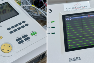 saude:-telemedicina-amplia-acesso-a-eletrocardiogramas-e-fortalece-atendimento-da-atencao-primaria-aos-postos-de-saude